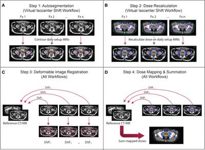 Dose accumulation for MR-guided adaptive radiotherapy: From practical considerations to state-of-the-art clinical implementation